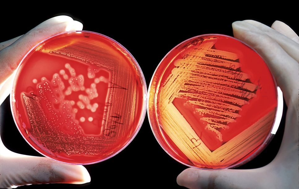 Doctorado en Ciencias de la Ingeniería, mención Ingeniería Química y Biotecnología